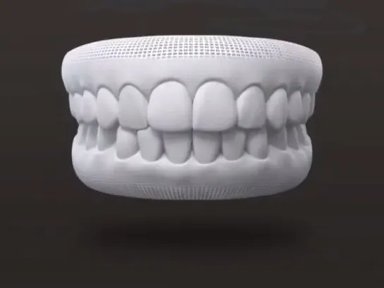 Escaneamento 3D de arcada dentária 4